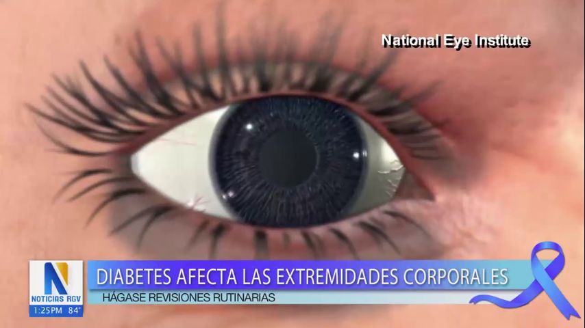 Corazón del Valle: Como la diabetes puede afectar las extremidades corporales