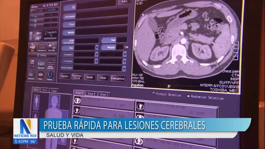 Nueva prueba detecta lesiones cerebrales