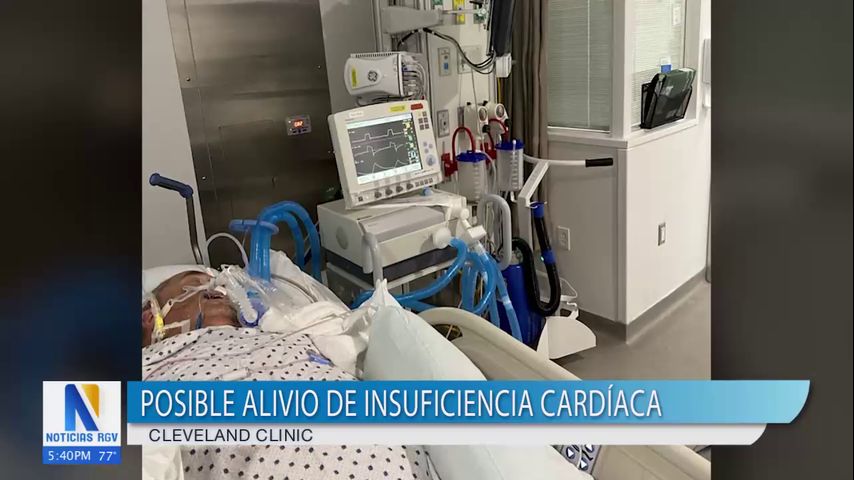 Cleveland Clinic contribuye nuevos avances al alivio de insuficiencia cardiaca