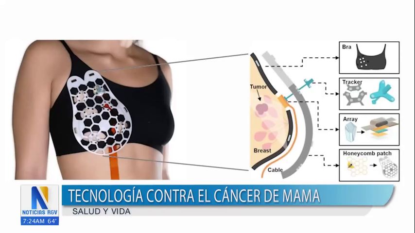 Impulsan nueva tecnología contra el cáncer de mama