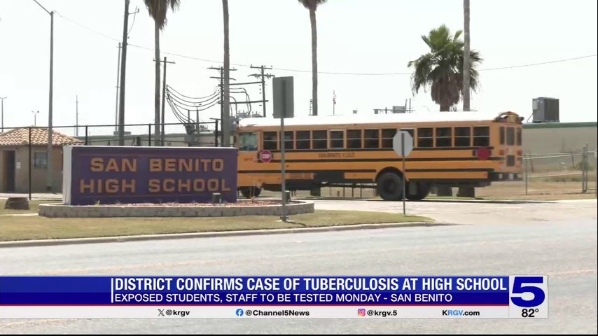 San Benito High School students and staff to be tested for tuberculosis following positive case