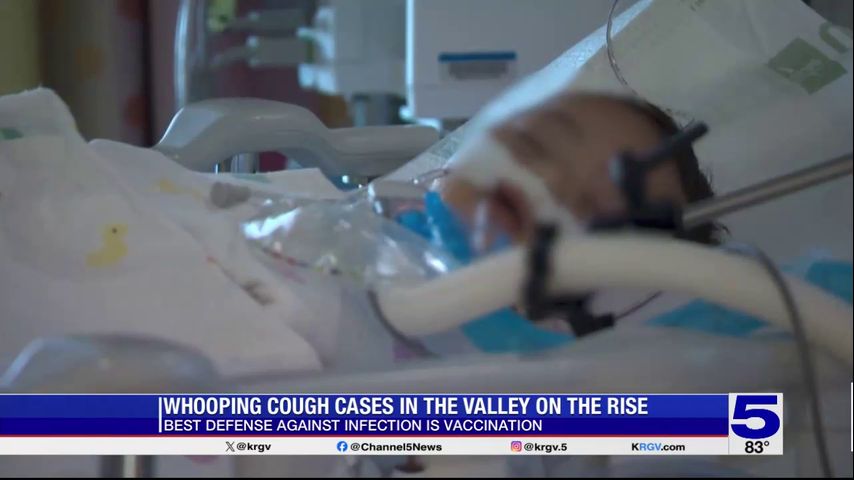 Valley health officials report increase in whooping cough cases