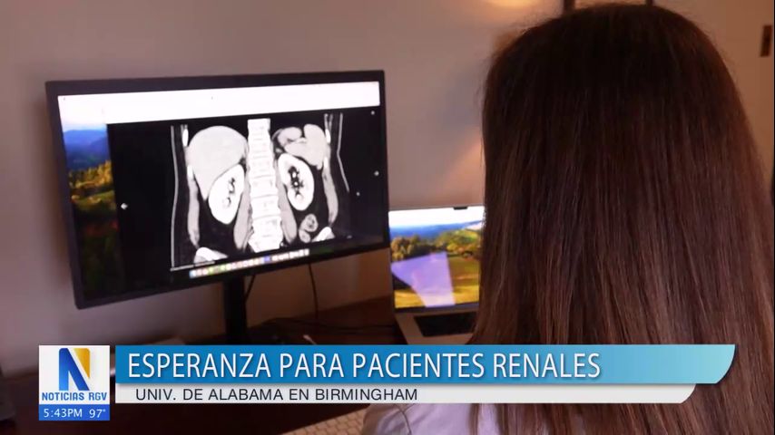 Tratamiento muestra avances para pacientes de enfermedades renales