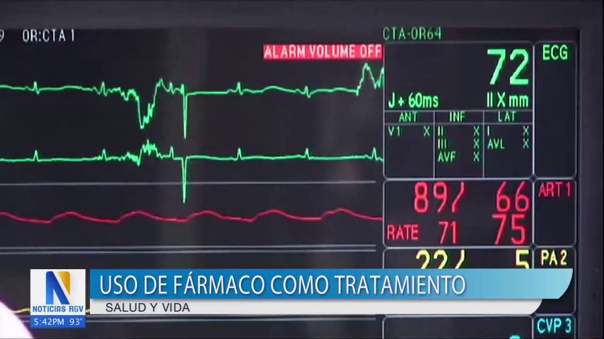 Estudio evalúa uso de fármaco como tratamiento para paciente que sufren de apoplejía