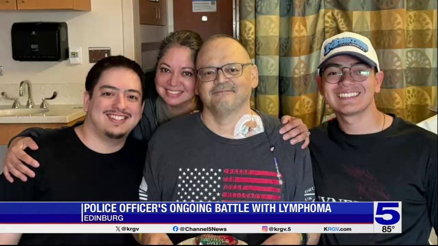 Edinburg police officer undergoing battle with Lymphoma