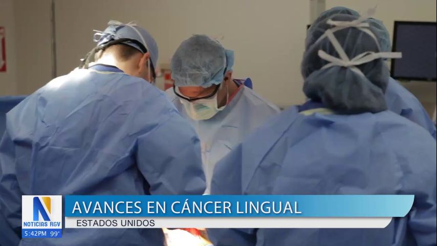 Salud y Vida: Nuevo tratamiento ofrece esperanza a sobrevivientes de cáncer en la lengua