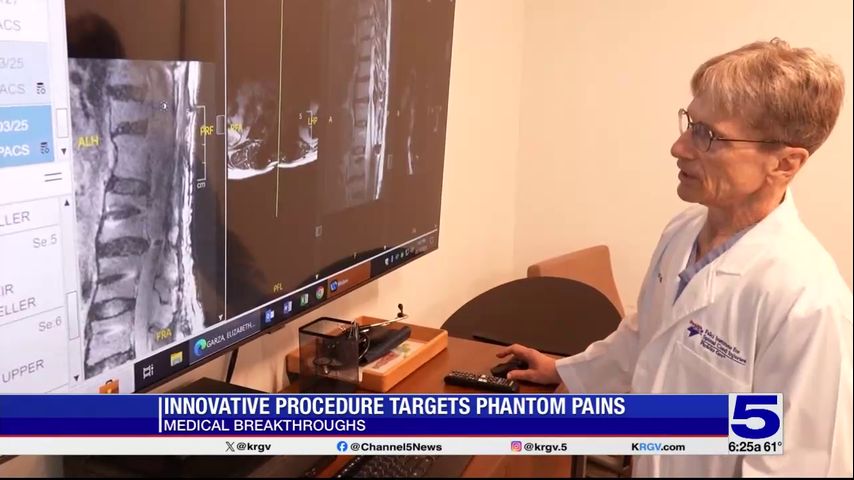 Medical Breakthroughs: Innovative procedure targets phantom pains