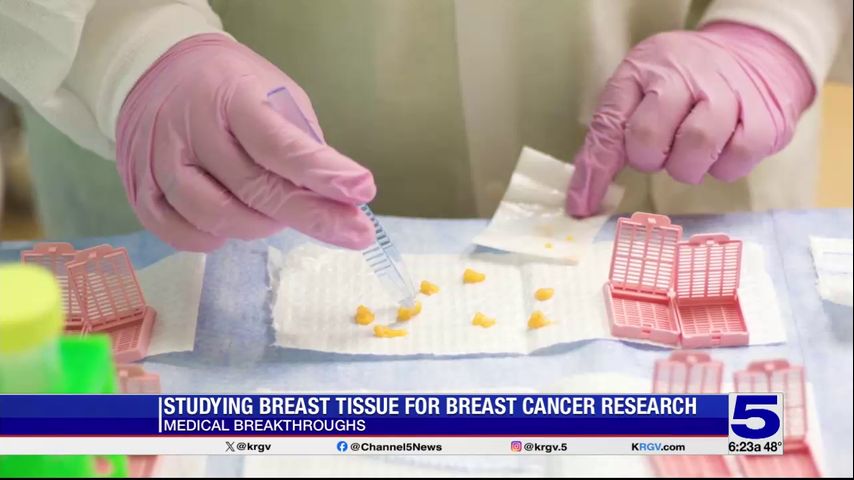 Medical Breakthroughs: Understanding the origins of breast cancer