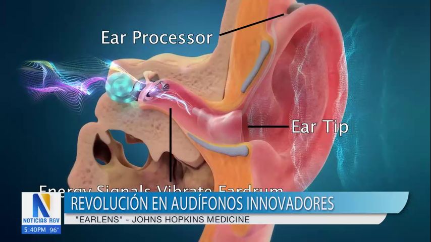 Audífonos innovadores mejoran la calidad de vida de personas con pérdida auditiva