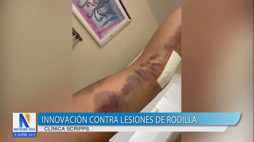 Salud y Vida: Cómo la cirugía de rodilla está cambiando la vida de atletas jóvenes