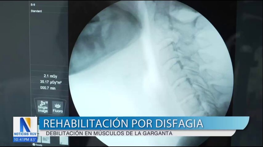 Rehabilitación precoz y tratamientos para la disfagia