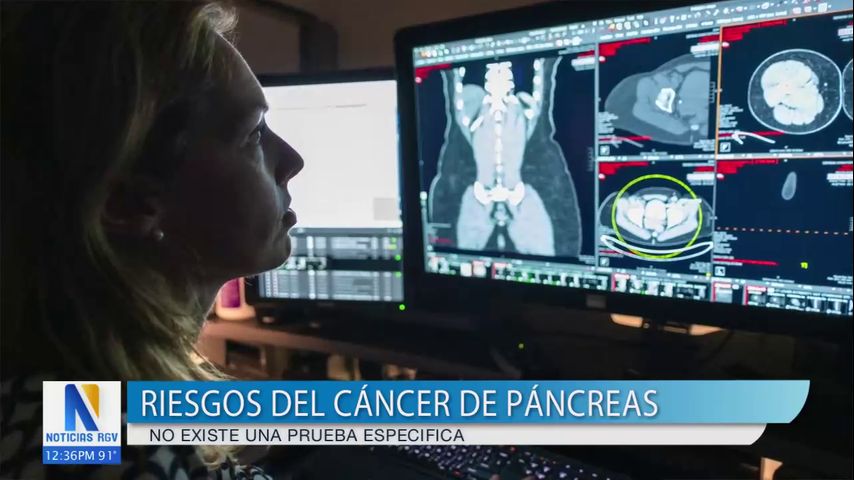 Destacan el uso de la inteligencia artificial en pacientes con cáncer de páncreas