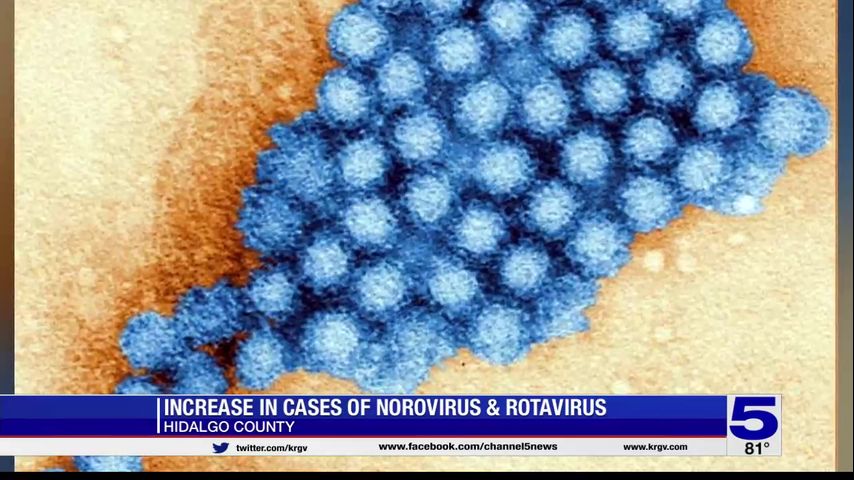 Hidalgo County reports increase in cases of stomach bugs