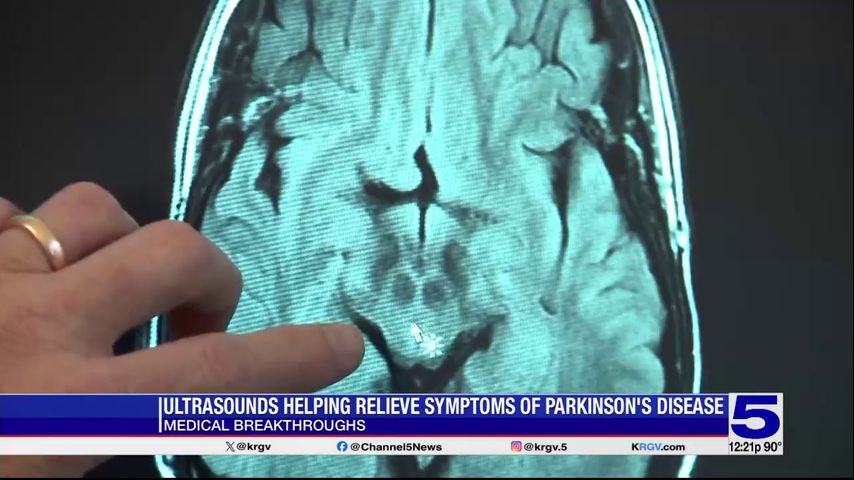 Medical Breakthroughs: Ultrasound device helping relieve symptoms of Parkinson’s disease