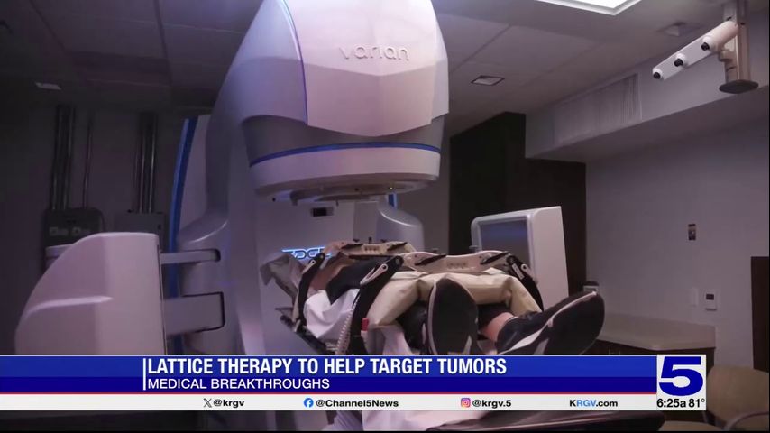 Medical Breakthroughs: Lattice therapy to help target tumors