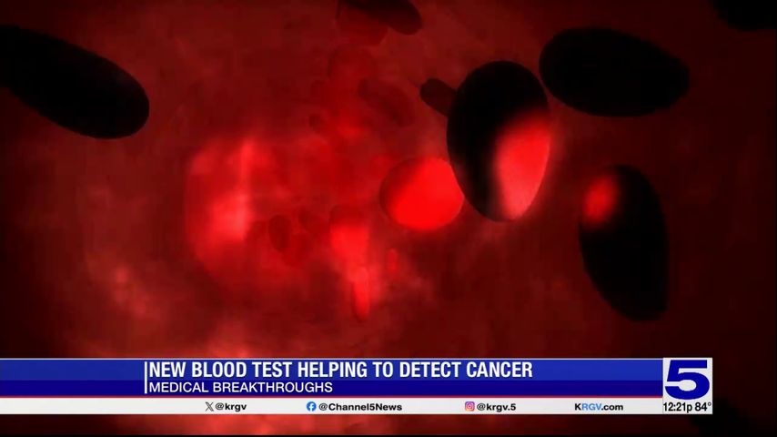 Medical Breakthroughs: New blood test helping detect cancer