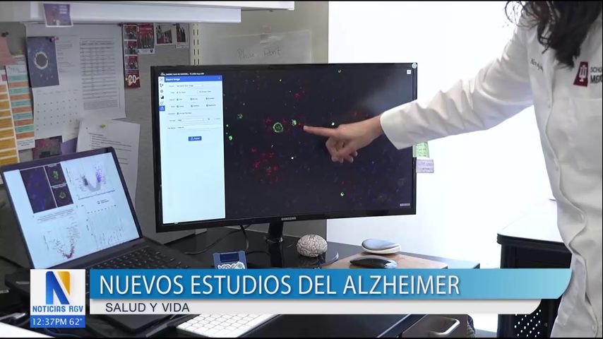 Investigan el desarrollo de nueva terapia para pacientes con Alzheimer