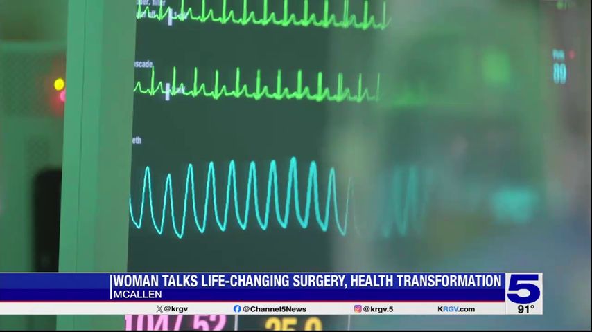 McAllen woman discusses her post-bariatric surgery transformation