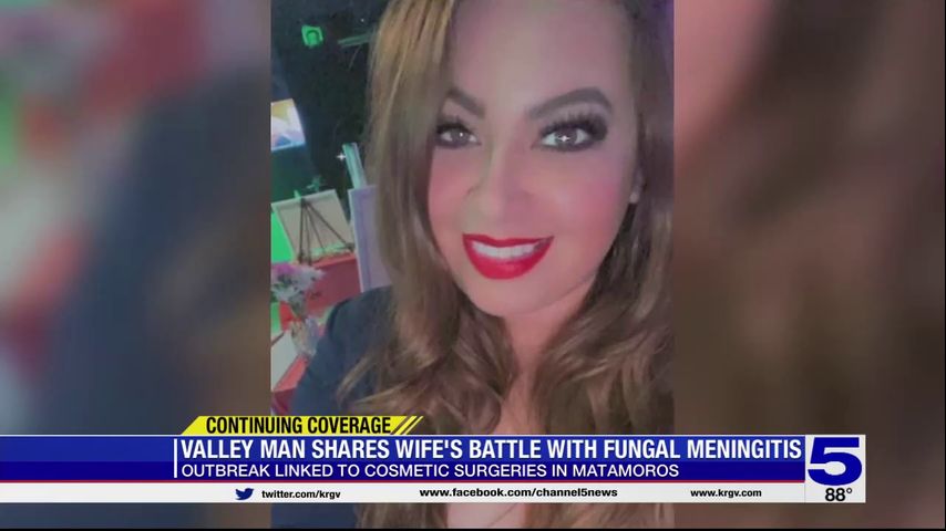 Valley man shares wife's battle with fungal meningitis