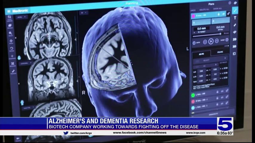 Biotech company working toward fighting off Alzheimer's