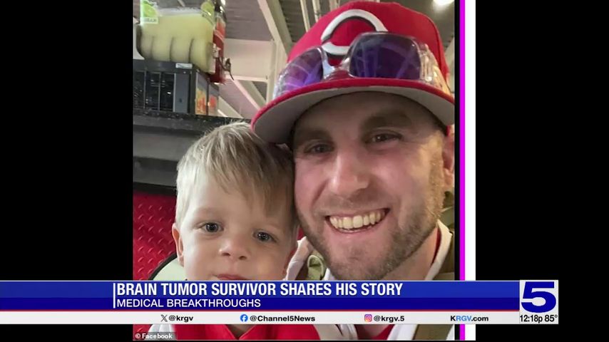 Medical Breakthroughs: Brain tumor survivor shares his story