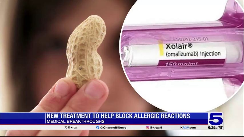 Medical Breakthroughs: New treatment to help block allergic reactions