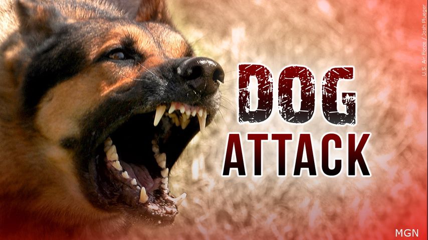 Raymondville police investigating dog attack on 2-year-old girl