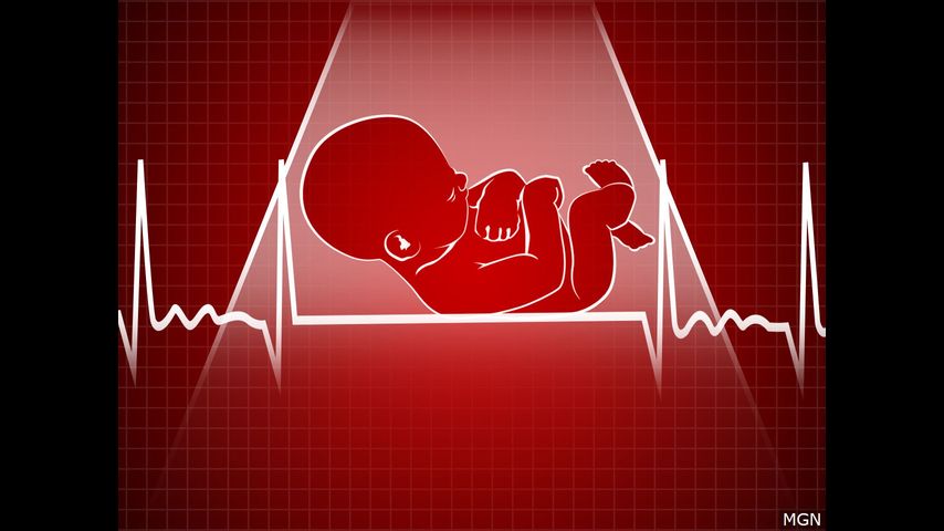 México: estado de Hidalgo aprueba despenalizar el aborto - Vimarsana News