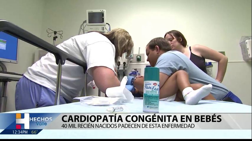 Cardiopatía congénita en bebes, miles de recién nacidos padecen de la enfermedad