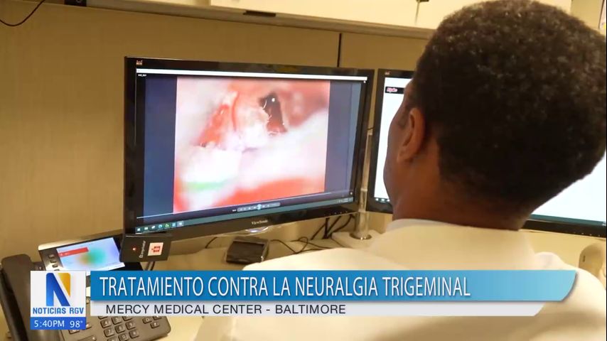 Avances en el tratamiento contra la neuralgia trigeminal