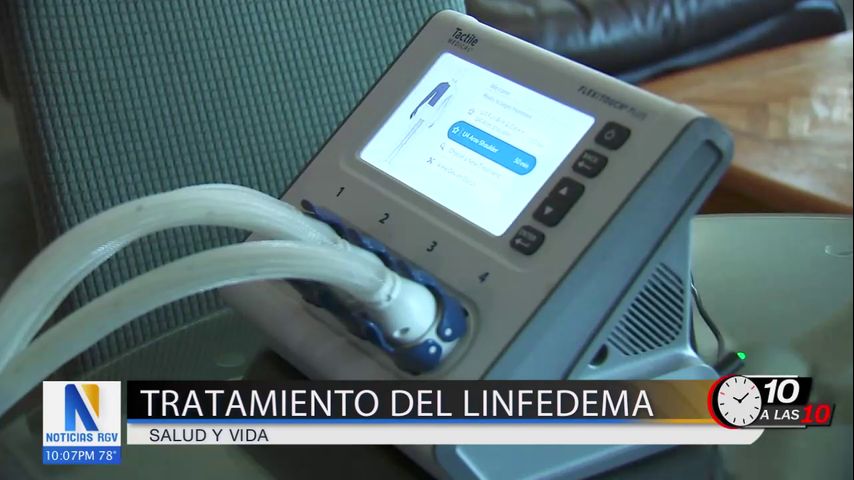 Nueva ley facilita acceso a tratamiento de linfedema para pacientes con cáncer de mama