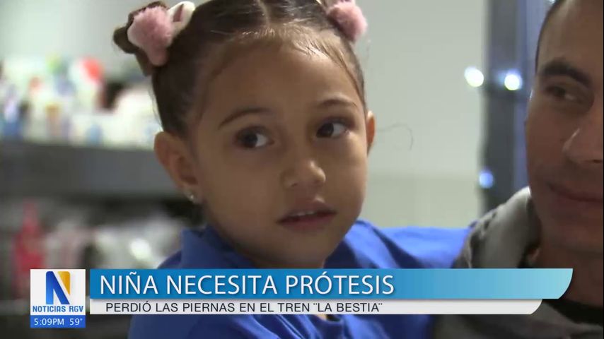 Niña necesita prótesis tras perder ambas piernas en el tren 'La Bestia'