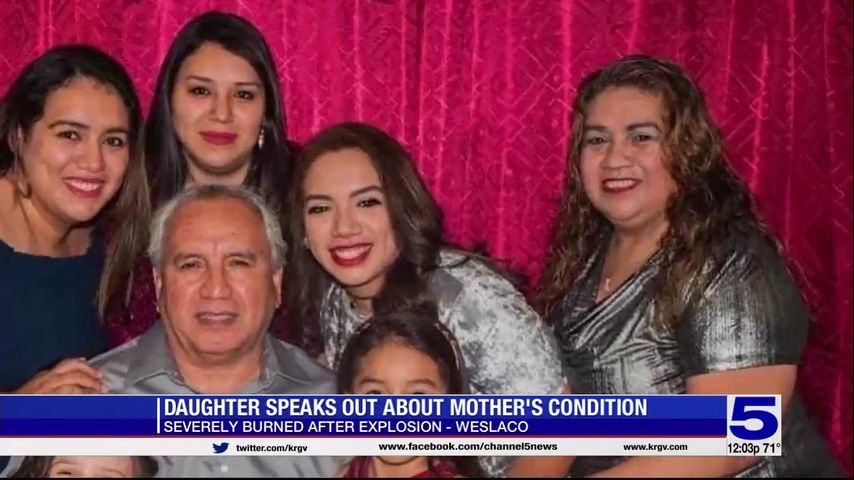 Daughter of woman severely burned from Weslaco restaurant explosion speaks out