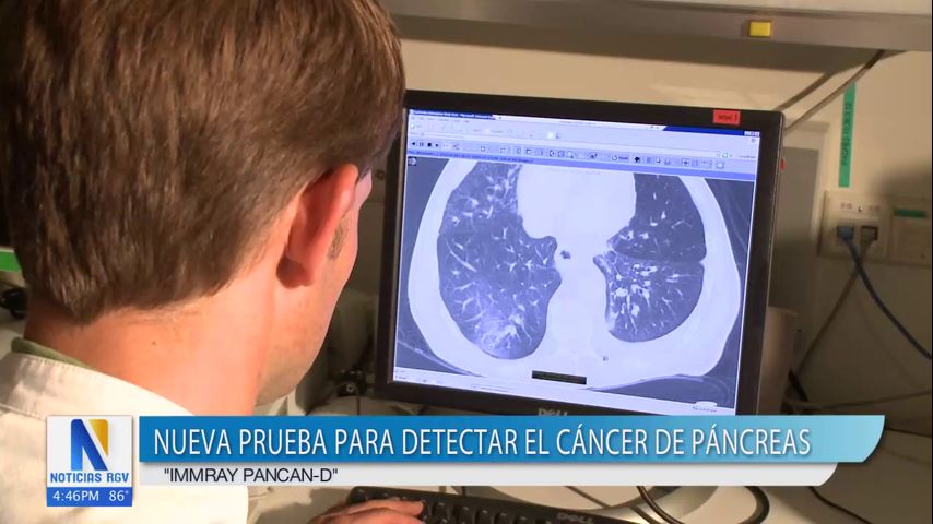 Salud y Vida: Nueva prueba puede detectar el cáncer de páncreas