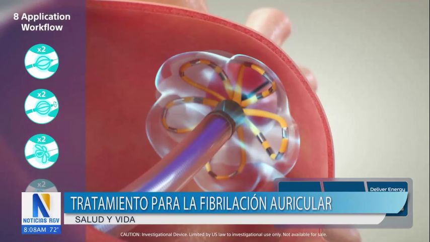 Desarrollan nuevo tratamiento para la fibrilación auricular