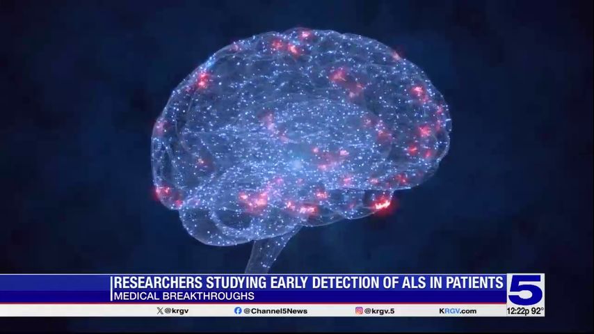 Medical Breakthroughs: Researchers studying early detection of ALS in patients