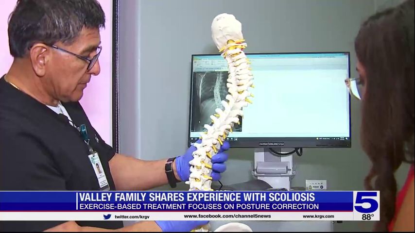 Valley family shares experience with scoliosis - Vimarsana News