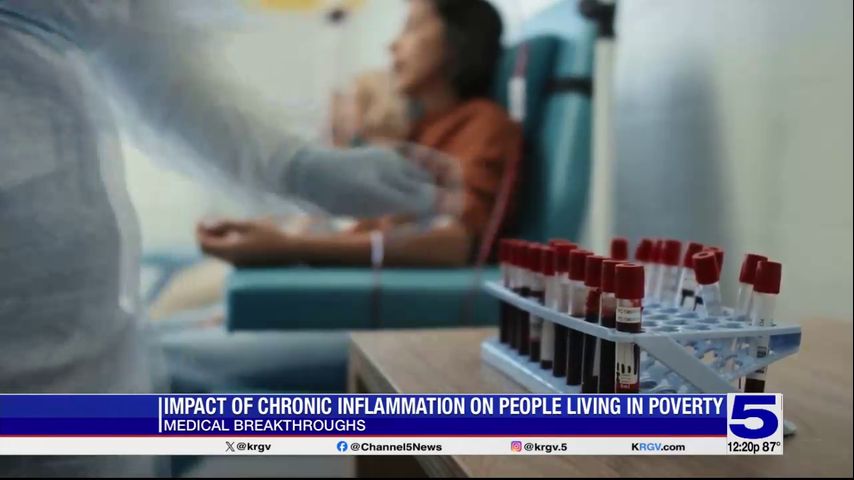 Medical Breakthroughs: New study focuses on impact of people living in poverty with chronic inflammation