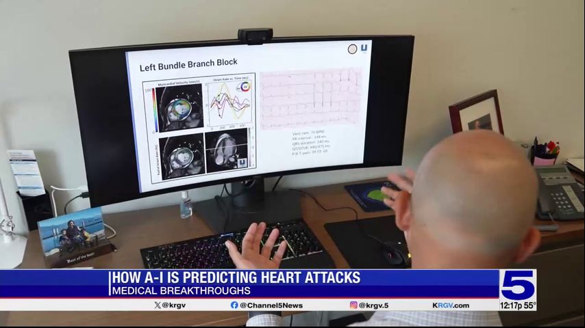 Medical Breakthroughs: How AI is predicting heart attacks