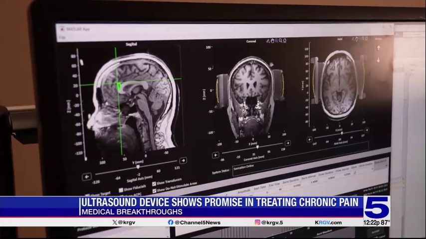 Medical Breakthroughs: Ultrasound device treating chronic pain