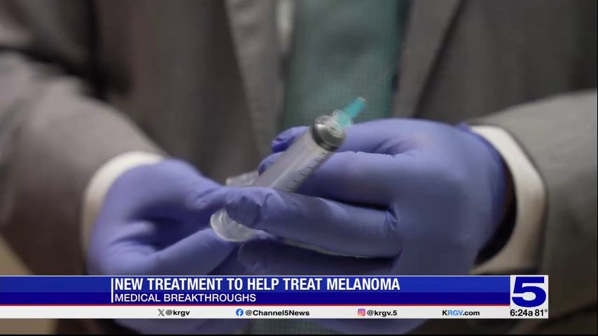 Medical Breakthroughs: New treatment to help treat melanoma