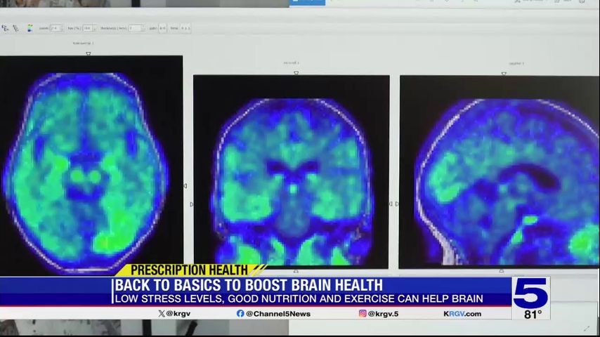 Prescription Health: Ways to boost your brain’s health