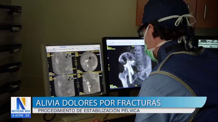 Salud y Vida: Nuevo procedimiento podría aliviar dolores por fracturas pélvicas