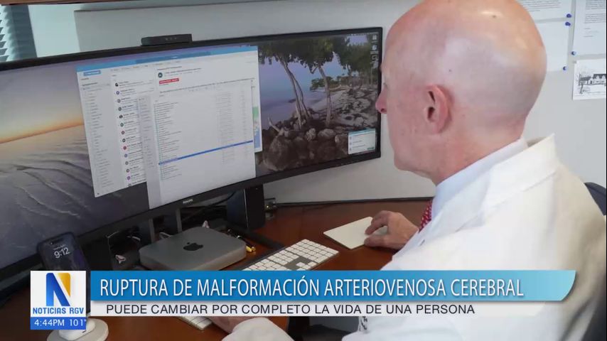 Salud y Vida: Especialistas médicos alertan sobre la ruptura de malformación arteriovenosa cerebral