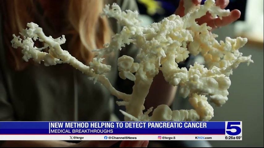 Medical Breakthroughs: New method helping to detect pancreatic cancer