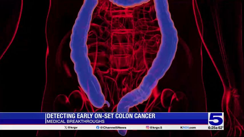 Medical Breakthrough: Detecting early on-set colon cancer