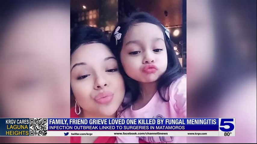 Houston woman killed by fungal meningitis after receiving surgery