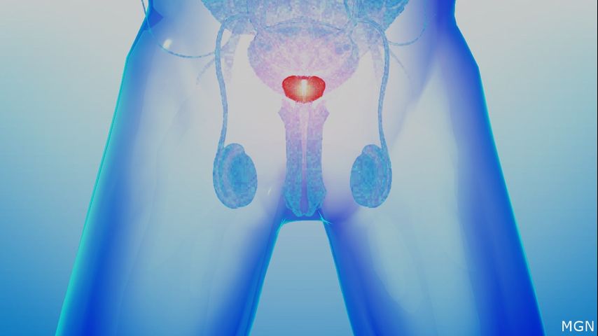 Read more about the article Learn more about the symptoms and treatments of an enlarged prostate