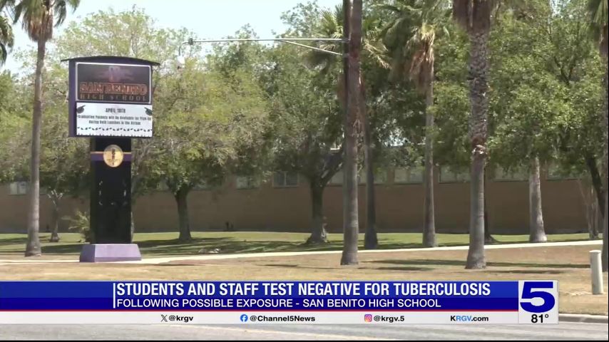 Students, staff at San Benito High School test negative for tuberculosis