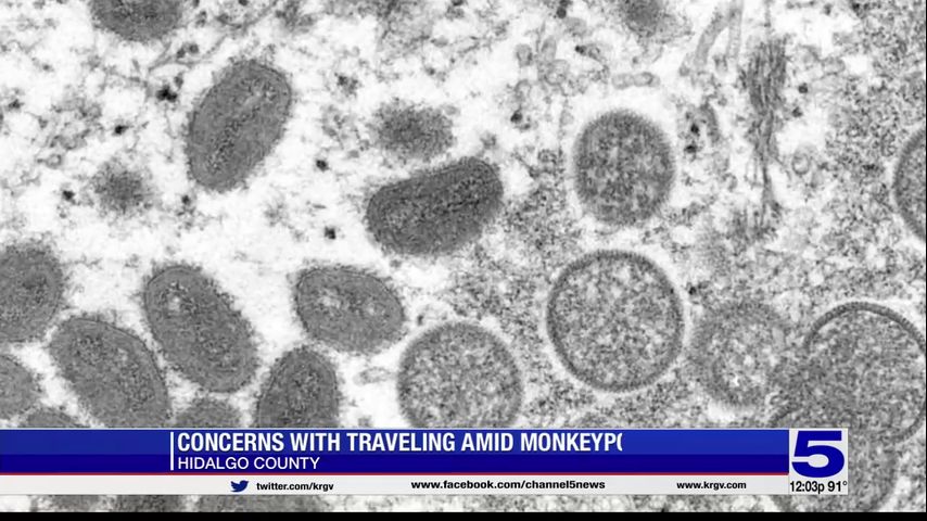 Valley health officials weigh in on concerns with traveling amid monkeypox spread in the state